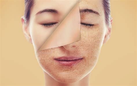 Perawatan kulit: Tips merawat kulit kering agar tetap lembut dan sehat