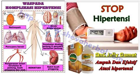 Strategi Efektif untuk Penanganan Hipertensi: Pedoman bagi Profesional Medis