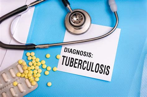 Mencegah Tuberkulosis: Cara yang Tepat untuk Menghindari Penyakit Menular Ini