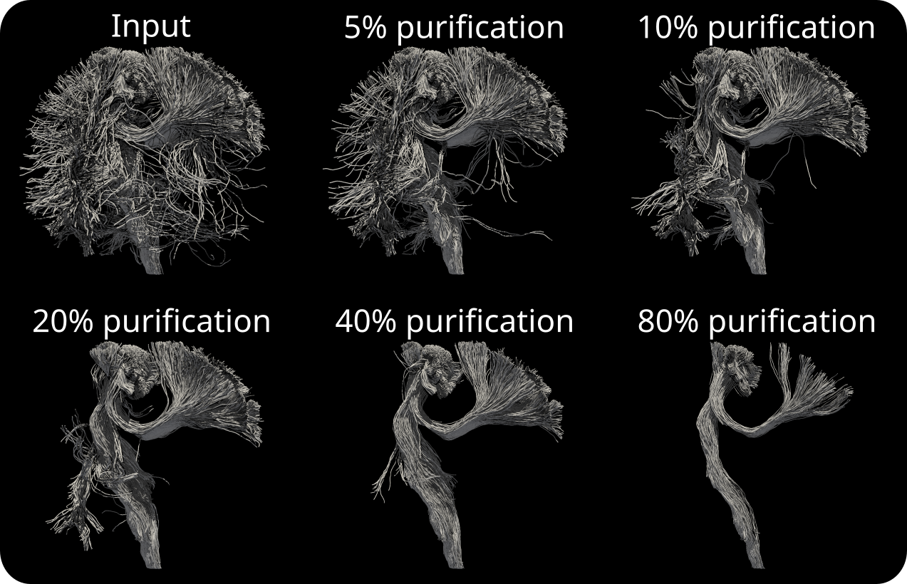 Real-time tractogram visualizer