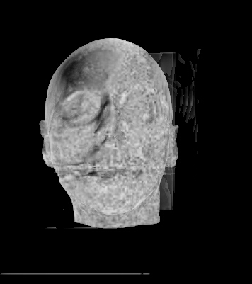 GitHub - bbbbyang/CT-Data-Visualization: CT Data Visualization C++ Code