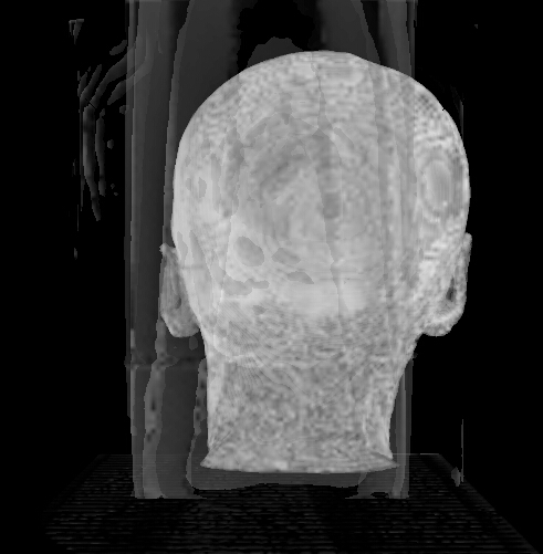 GitHub - bbbbyang/CT-Data-Visualization: CT Data Visualization C++ Code