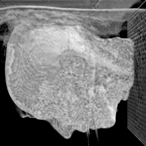 GitHub - bbbbyang/CT-Data-Visualization: CT Data Visualization C++ Code