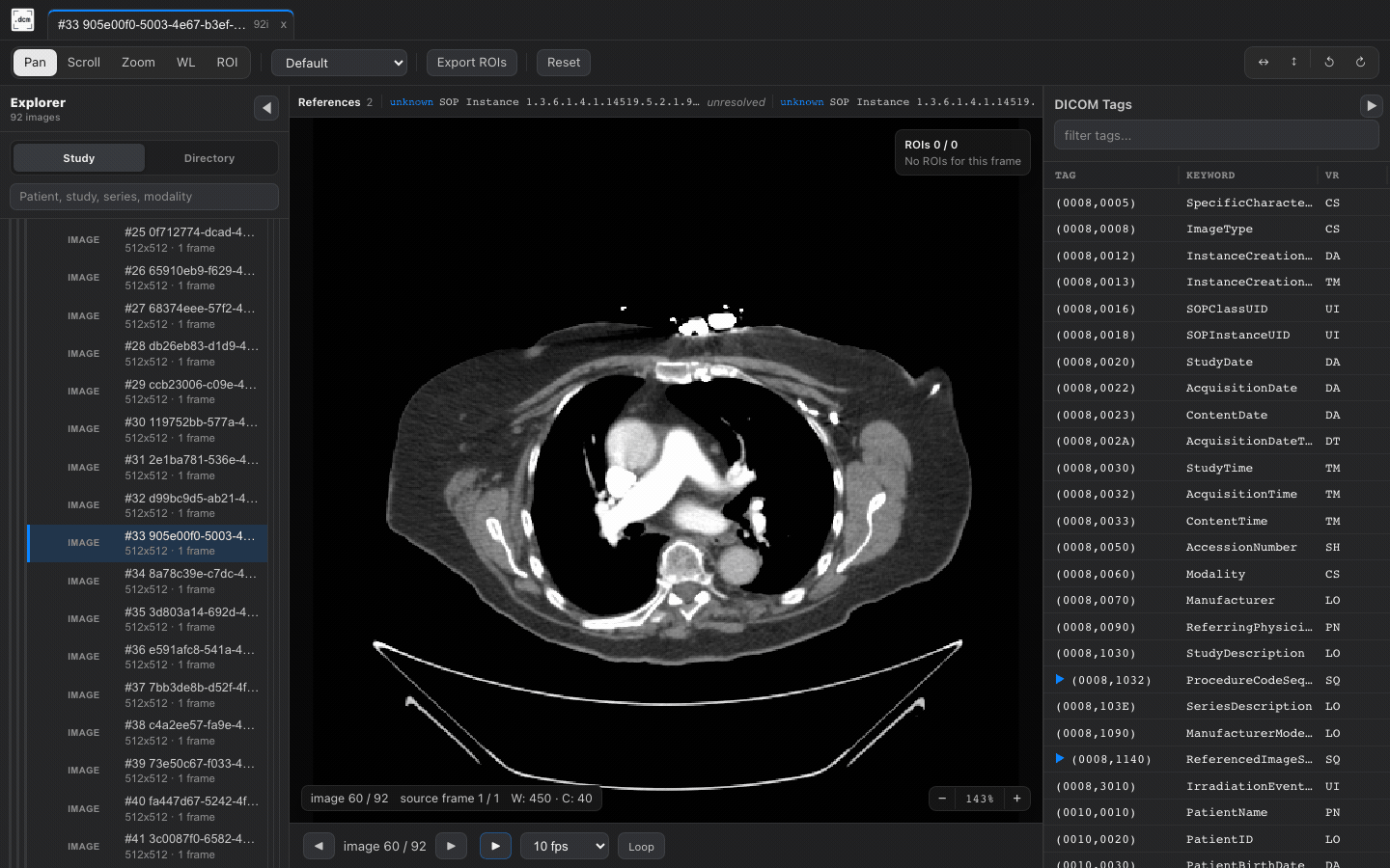 DICOM cine playback in dcmview