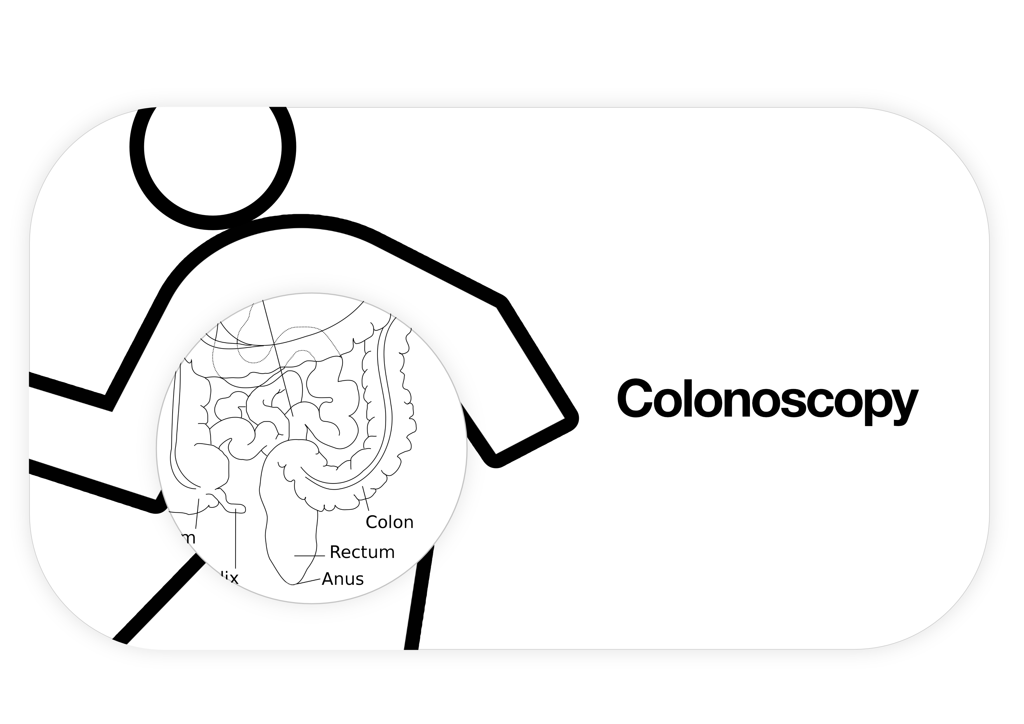 an illustration of a person and their intestine next to the word 'colonoscopy'
