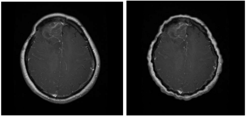 elastic deformation before and after