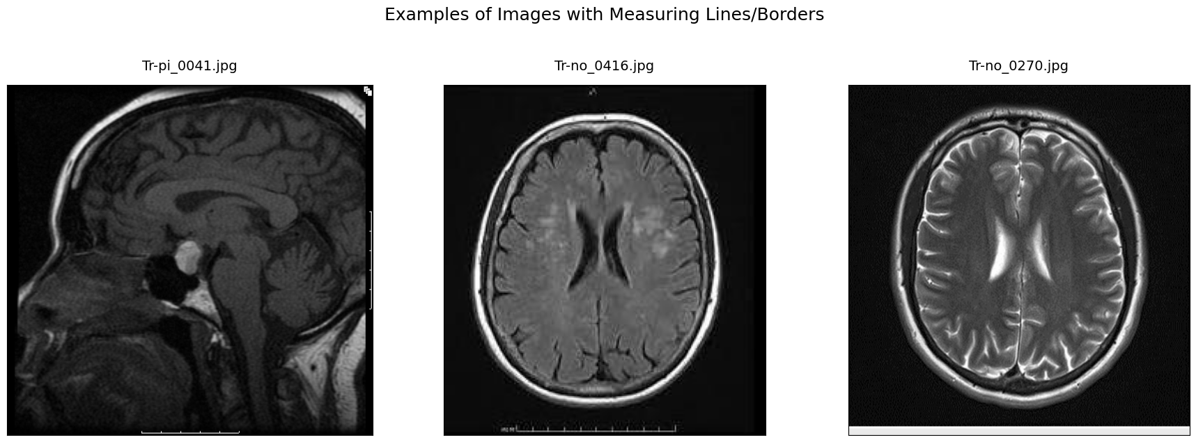 example of artifacts 2