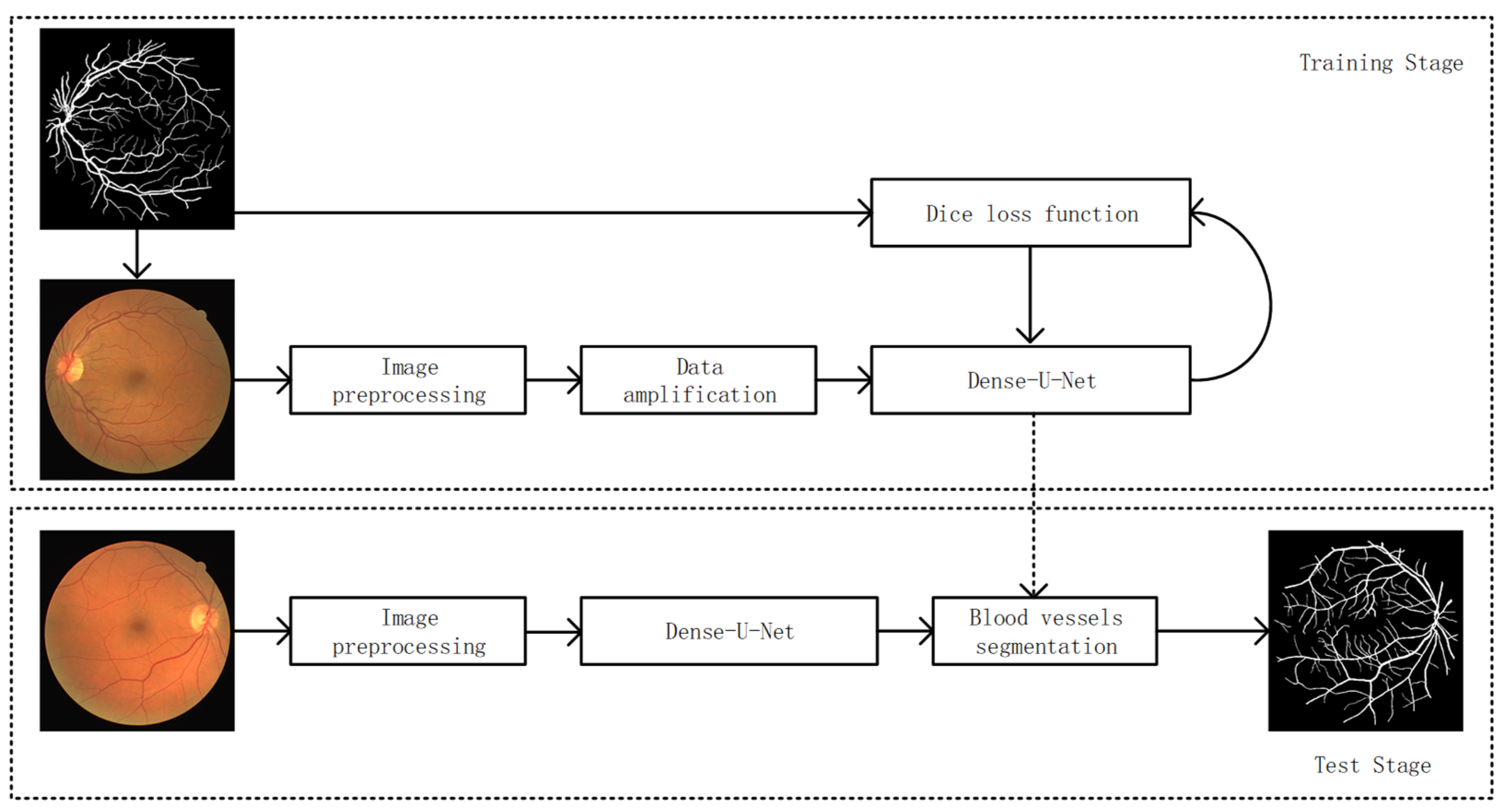 GitHub - bhaktii1802/Unet-Segmentation · GitHub