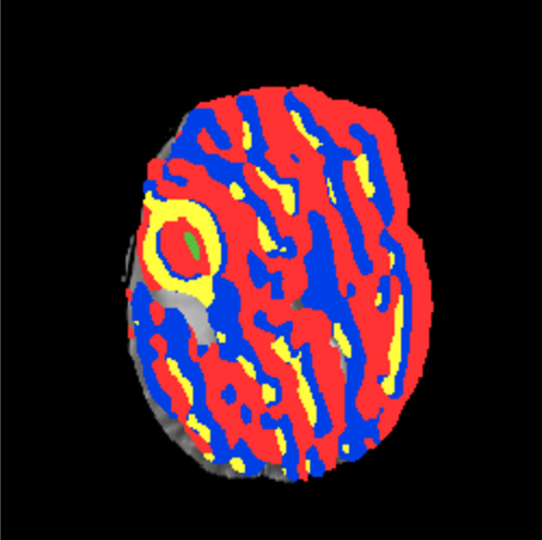 Results of initial segmentation