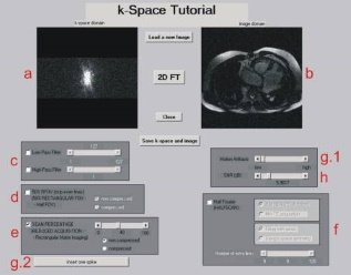 Screenshot from k-Space Tutorial by D. Moratal et al.