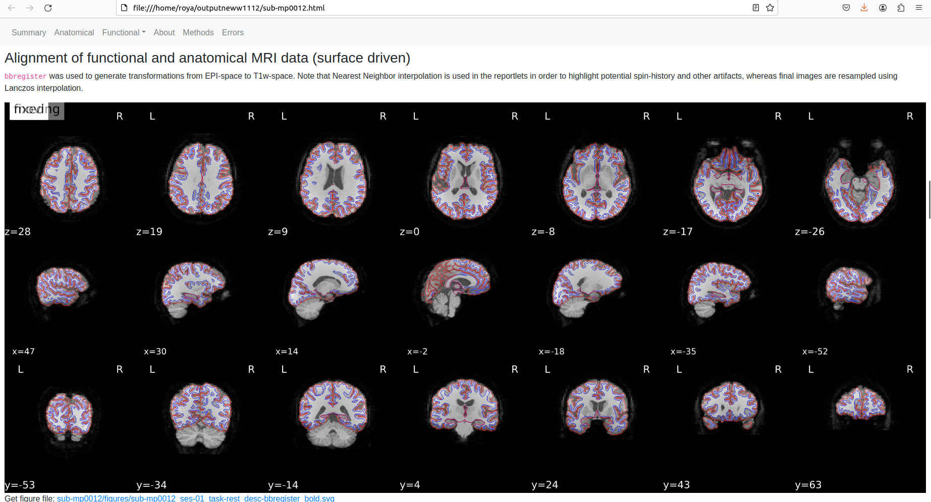 Alignment-functional-anatomical-fmriprep