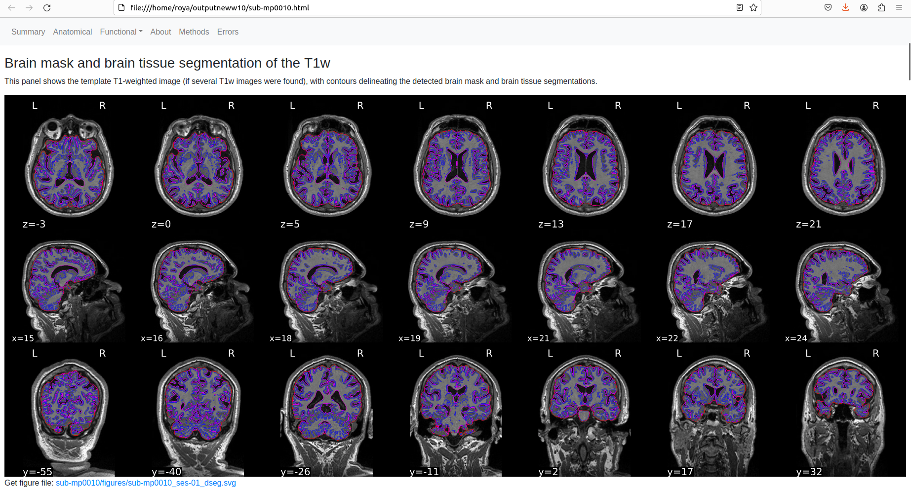 Brain-mask-fmriprep