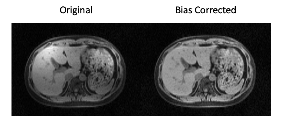 Bias Correction Demonstration