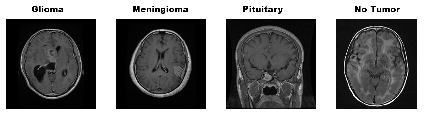 Image of Brain MRI