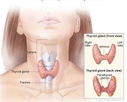 parathyroid