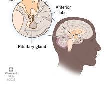 pituitary