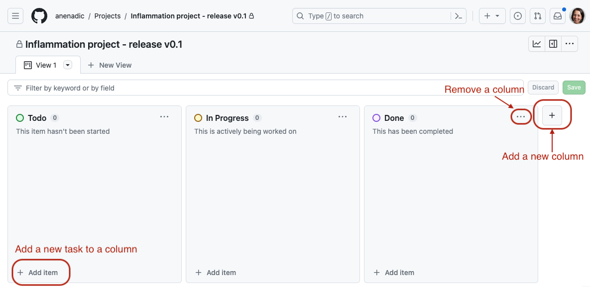 Screenshot showing default card board in GitHub. Three columns are shown headed Todo, In Progress and Done. A button to add a new task to a column is highlighted at bottom of Todo column. On the right of interface the "Actions for column" button which expands a menu from which a column can be removed and the "Add a new column to the board" (+) button which can be used to add a new column are highlighted.