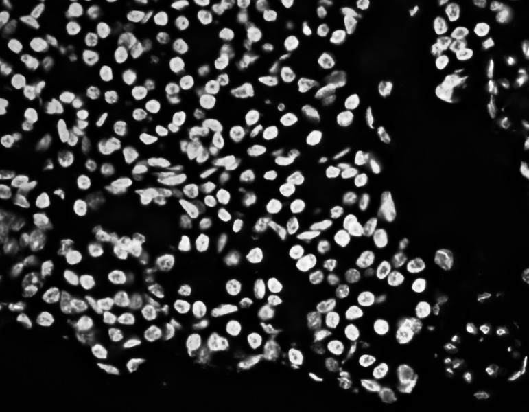 Nuclei sample 2