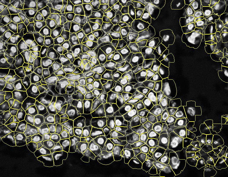 PIPEX segmentation 4