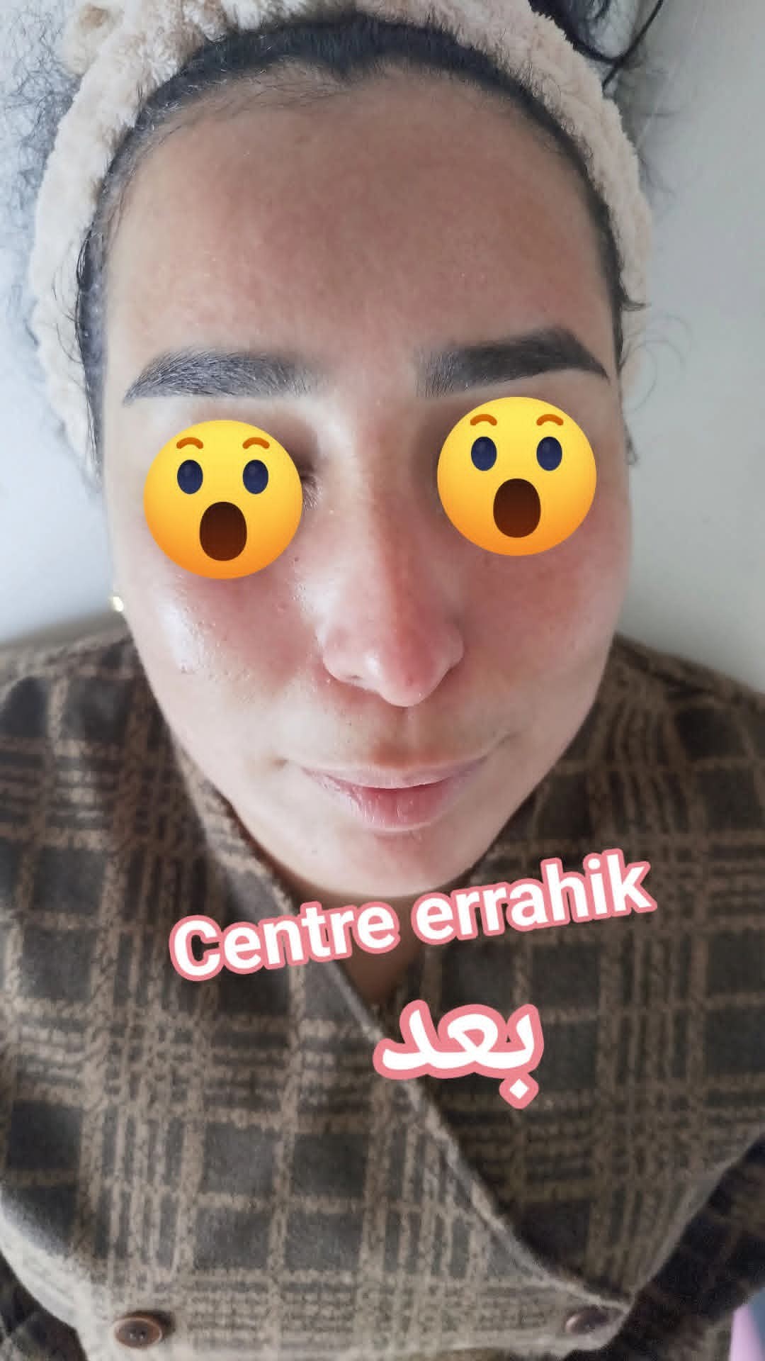 Soin visage après 2