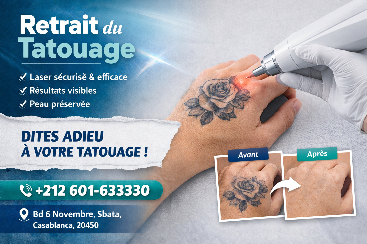 Promotion Détatouage