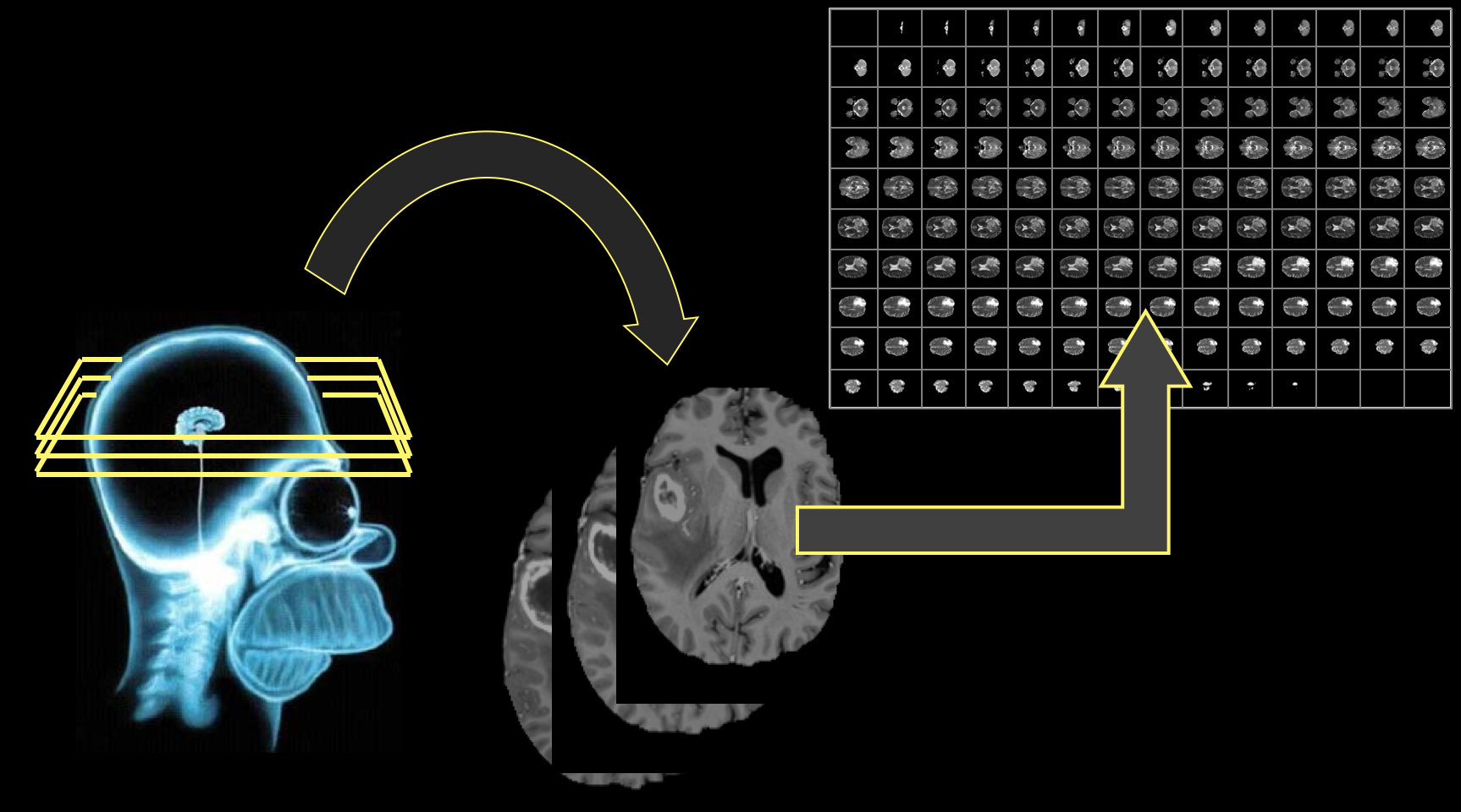 Basic MRI Workflow