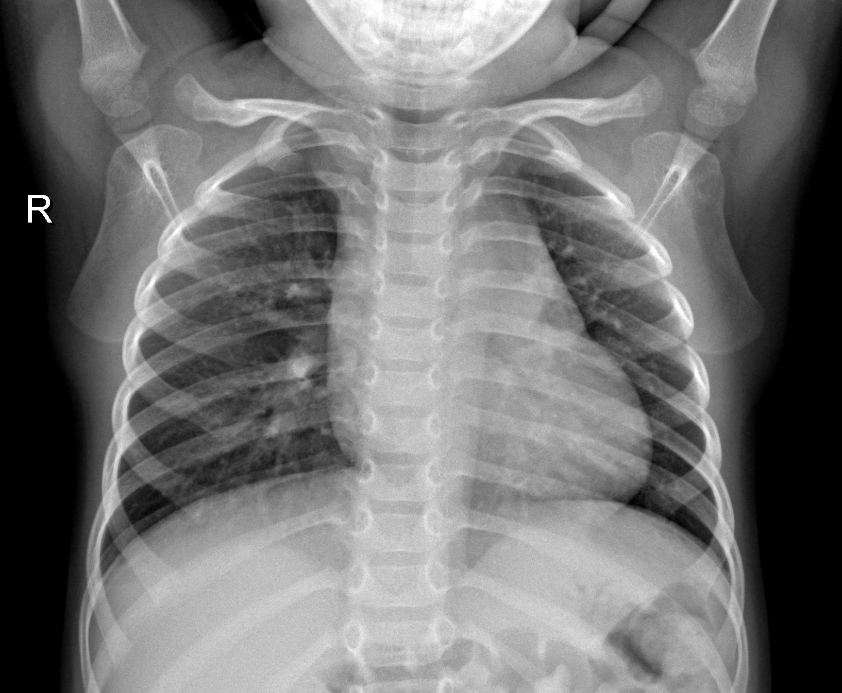 Normal X-ray Sample