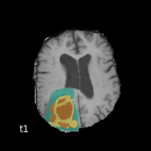 Image of Segmentation