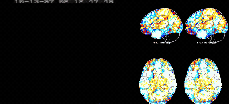 Comparison of FP32 baseline vs Rarámuri BF16+Parakeet inference on JFK's Cuban Missile Crisis address (first 35 seconds). Lateral and top-down glass brain projections show the two paths are visually indistinguishable.