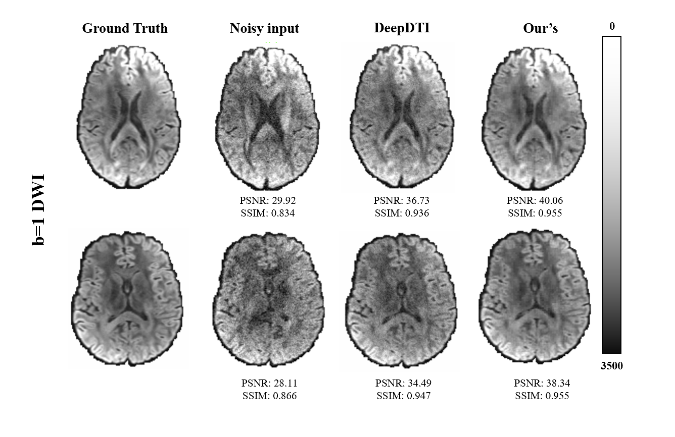 Denoising b=1 Volumes