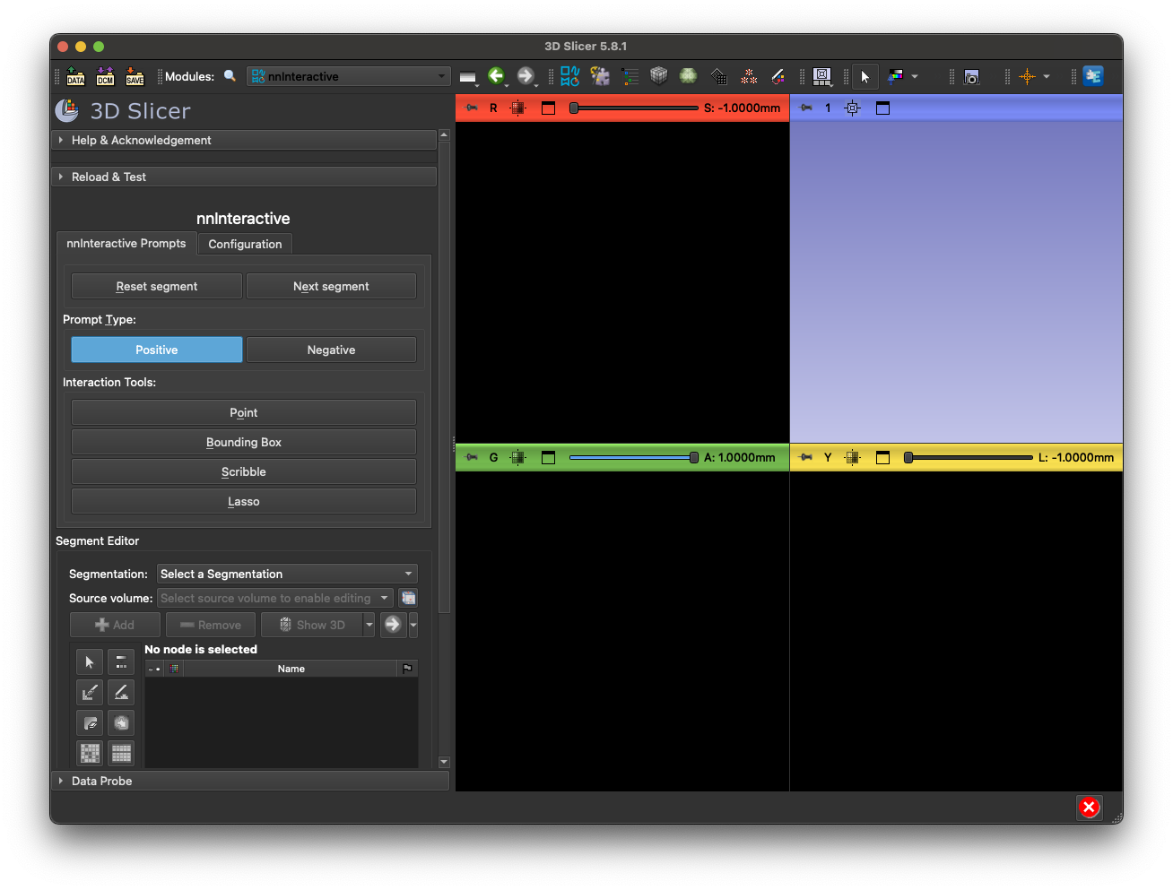 First view of the Slicer extension