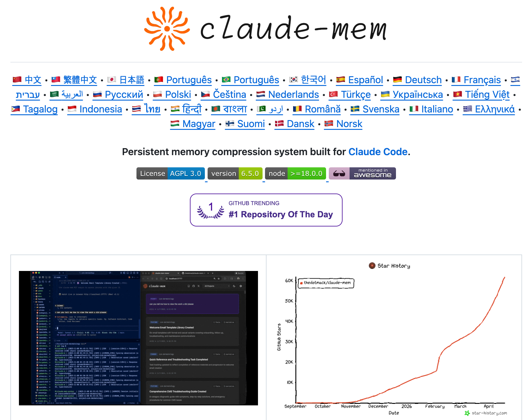 Claude Code 오픈소스 7선: 반년 쓰고 추려낸 것만 - claude-mem