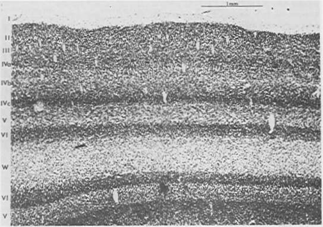 猫の視覚野のスライス。6 つの主要な皮質層 (I ～ VI) と、視覚野にのみ存在する第 IV 層の下層を示します。最初の層 (I) は主に軸索 (「白質」) です。 Sejnowski と Churchland (1989) から再録。