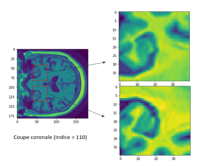 2D slice of a 3D MRI image of the brain