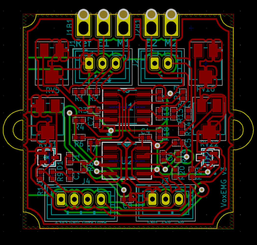 VoxEMG, from the project README