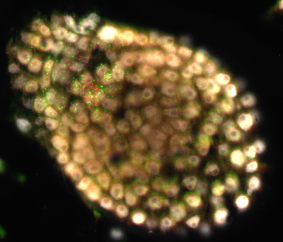 Kalanchoe foliar embryo, globular stage