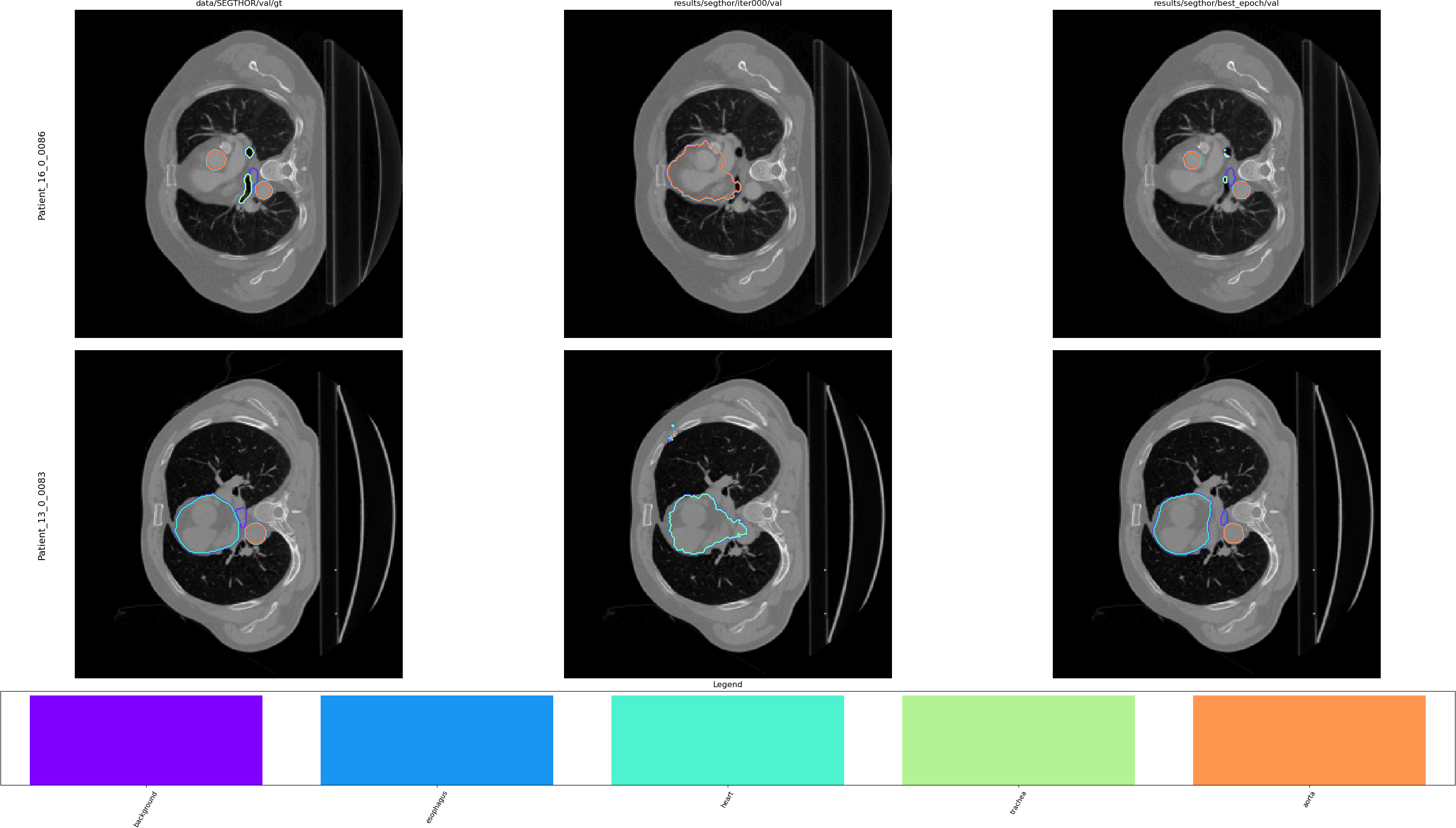 Example of the viewer on SegTHOR