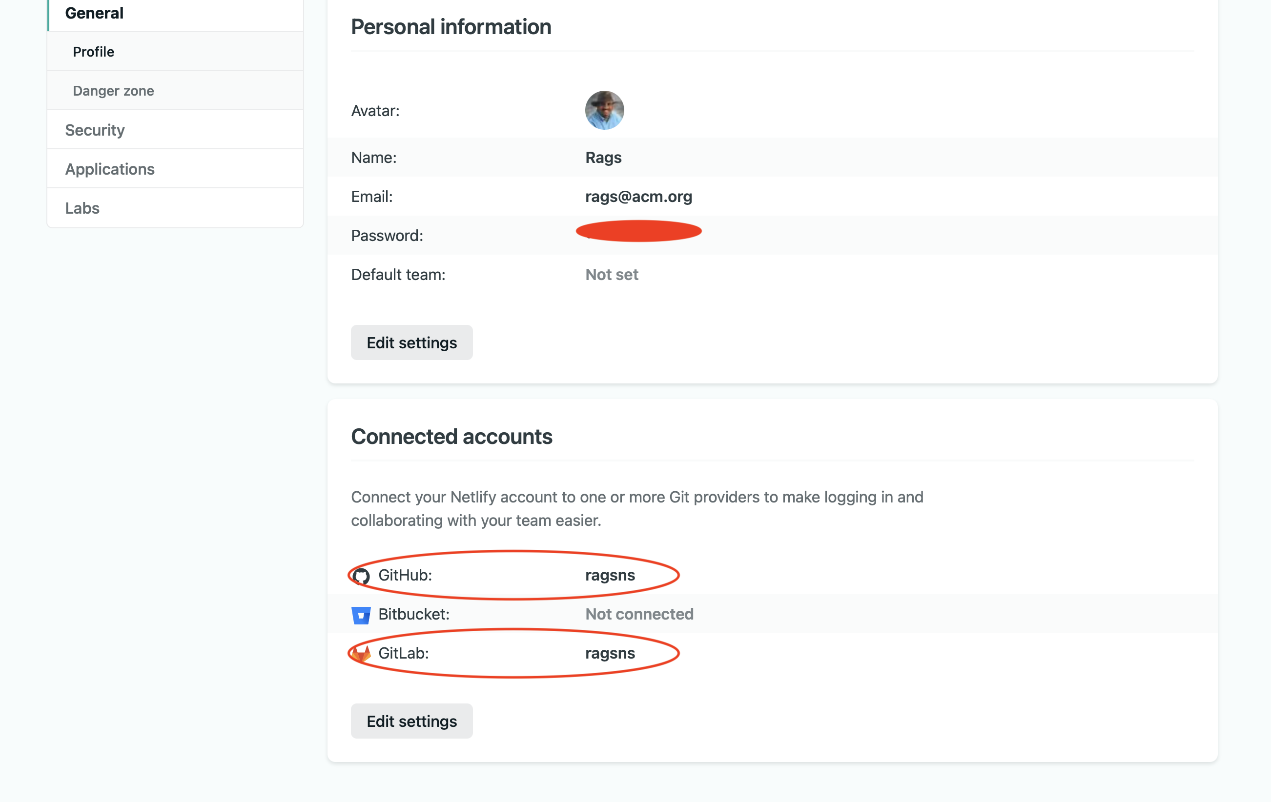 Deploy to Netlify, "connected accounts"