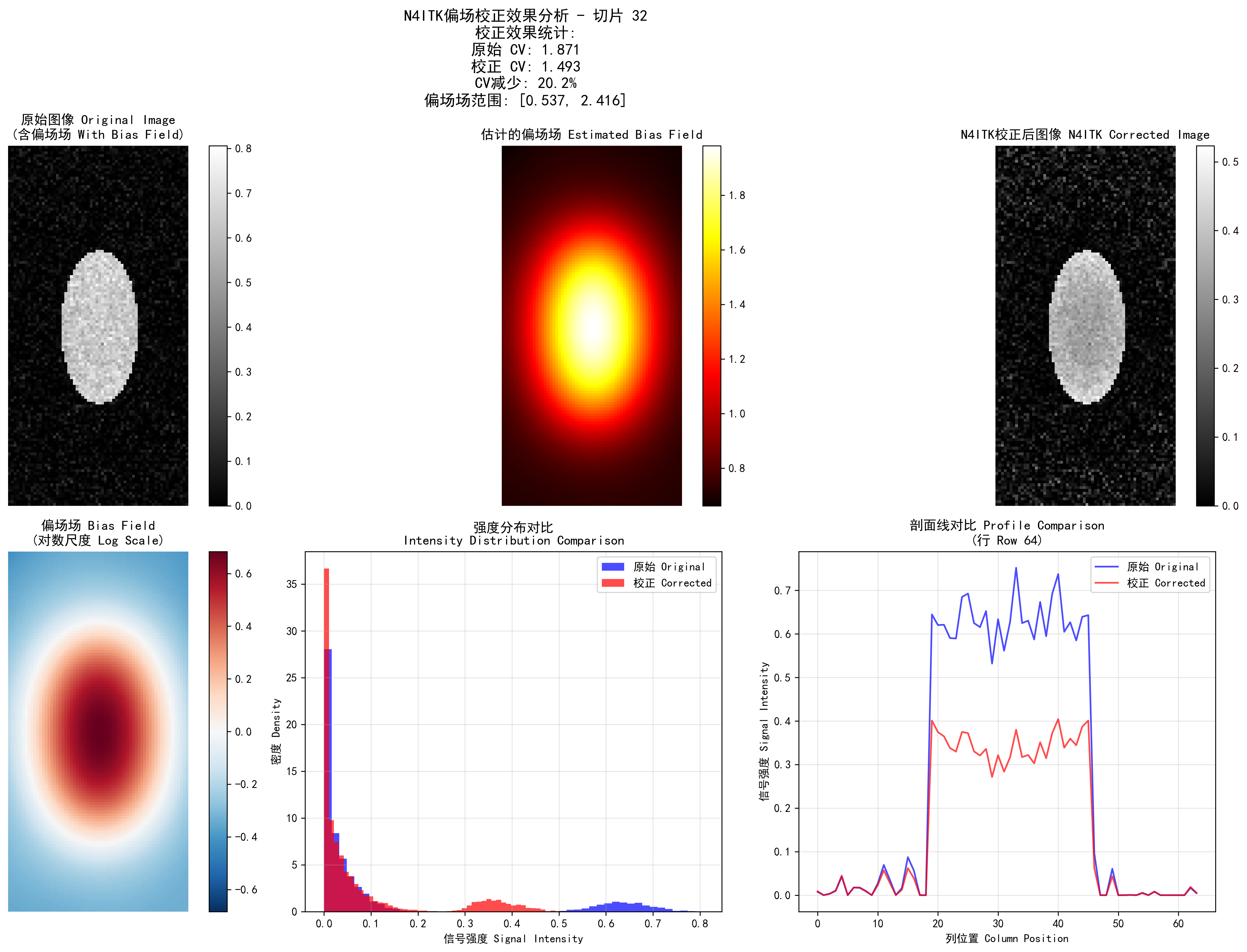 N4ITK偏场校正效果