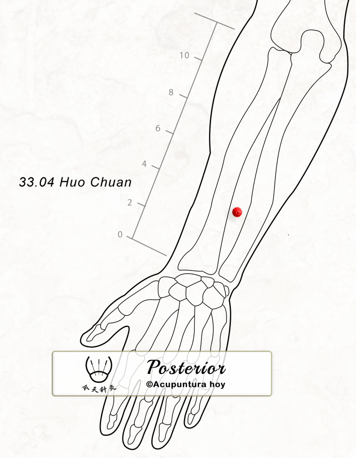 33.04 Huo Chuan 火串穴