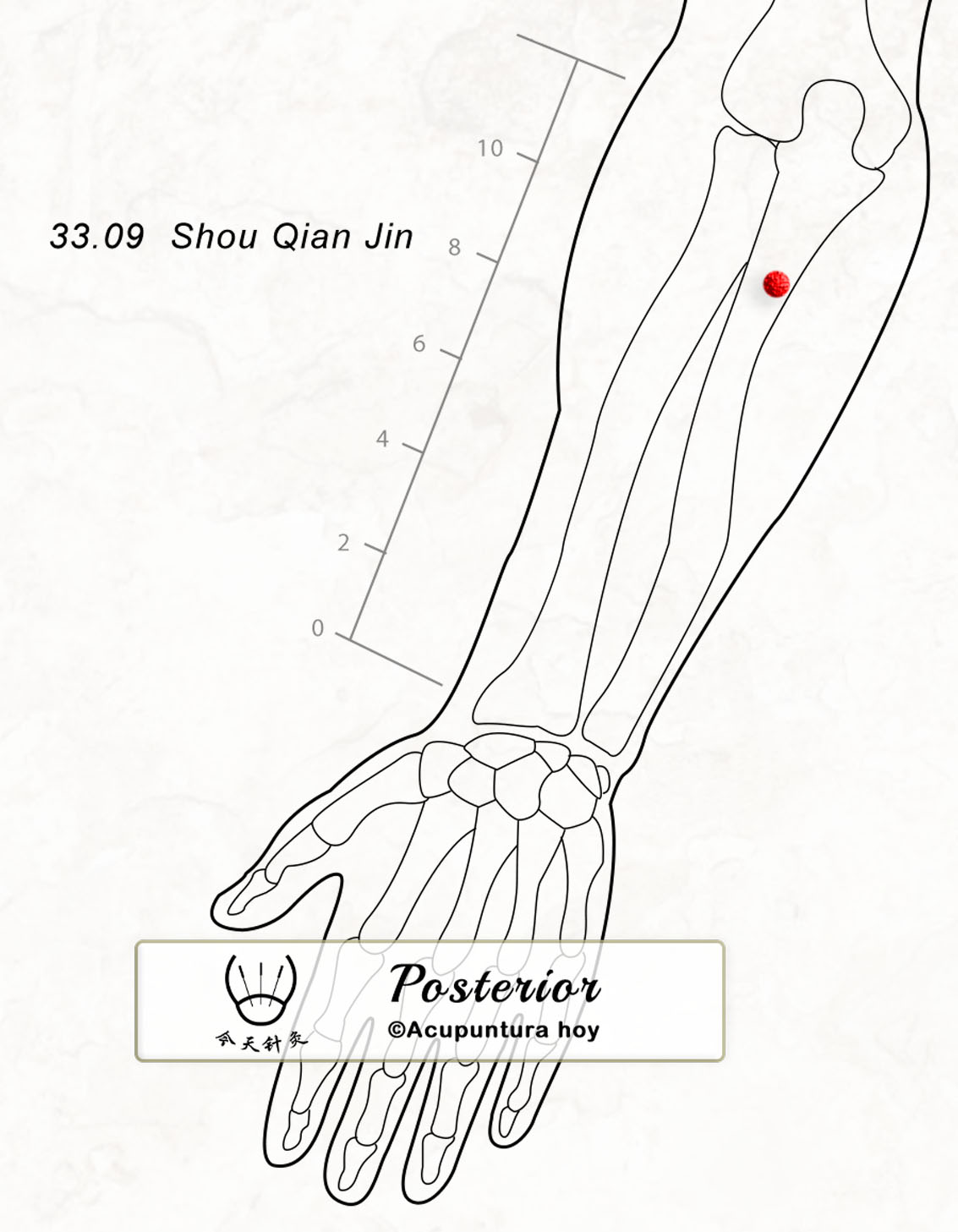 33.09 Shou Qian Jin 手千金穴