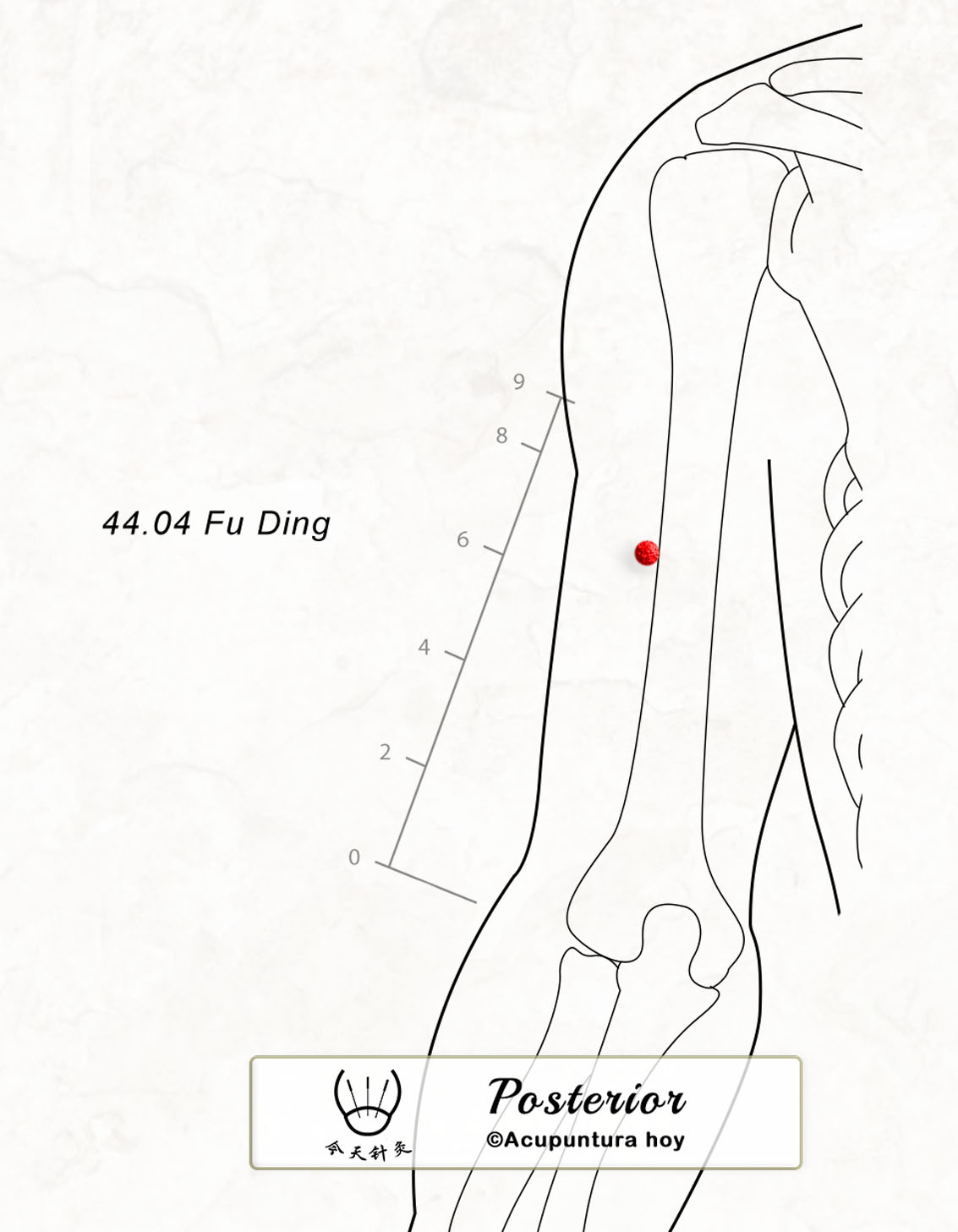 44.04 Fu Ding 首頂穴