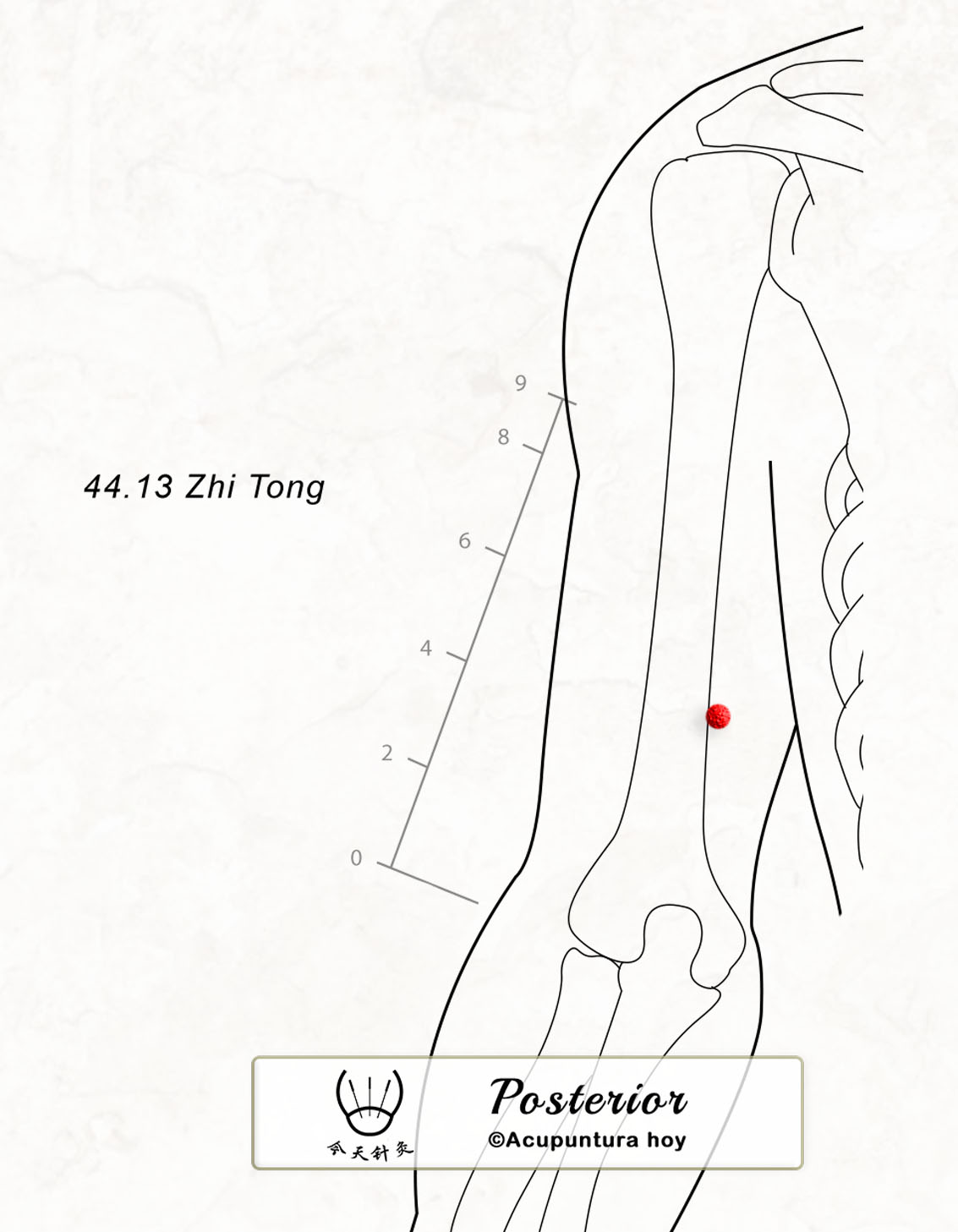 44.13 Zhi Tong 支通穴