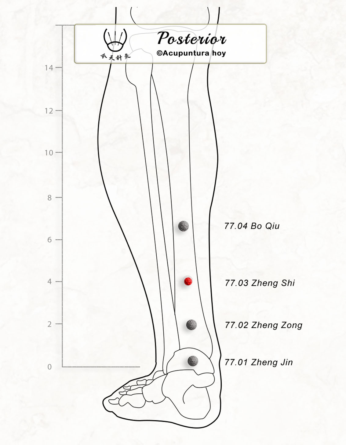 77.03 Zheng Shi 正士穴