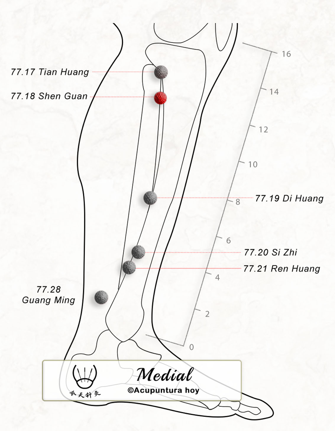 77.18 Shen Guan 肾闗穴
