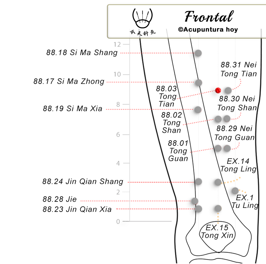 88.03 Tong Tian 通天穴