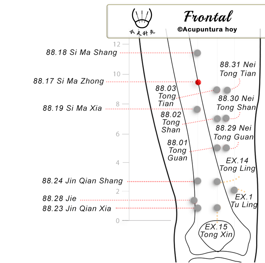 88.17 Si Ma Zhong 駟馬中穴