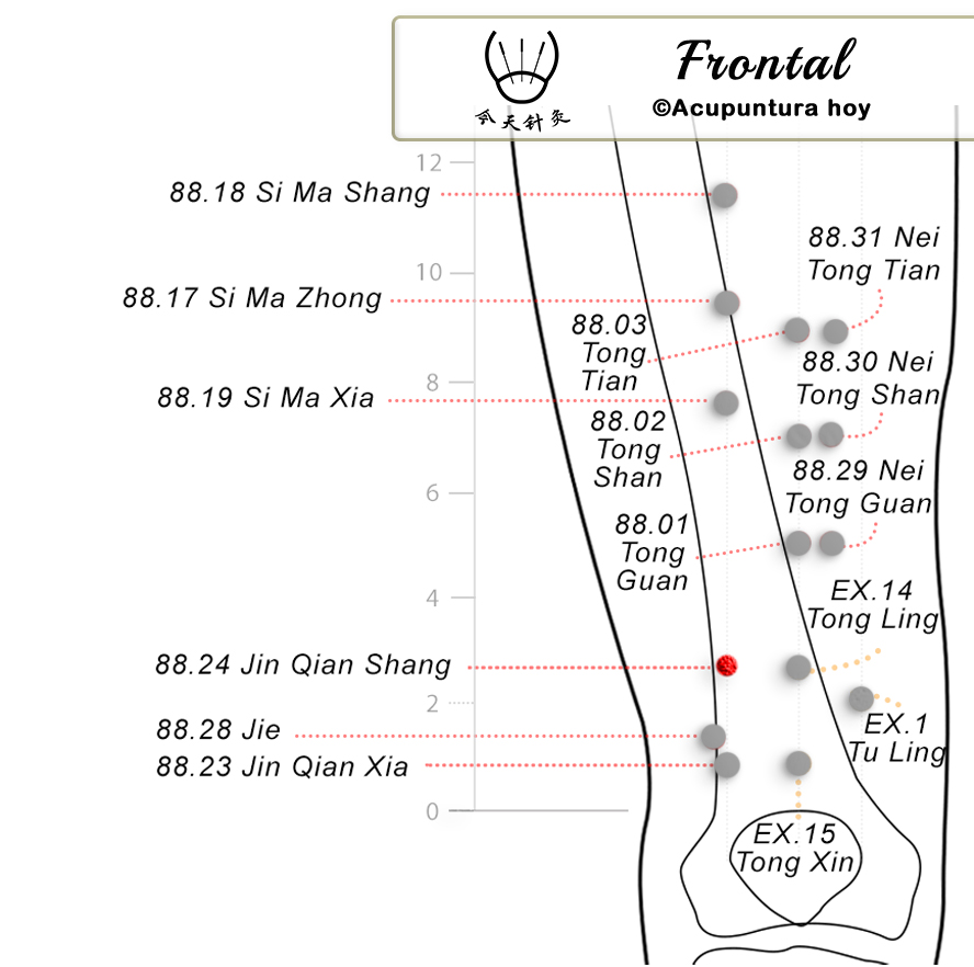 88.24 Jin Qian Shang 金前上穴