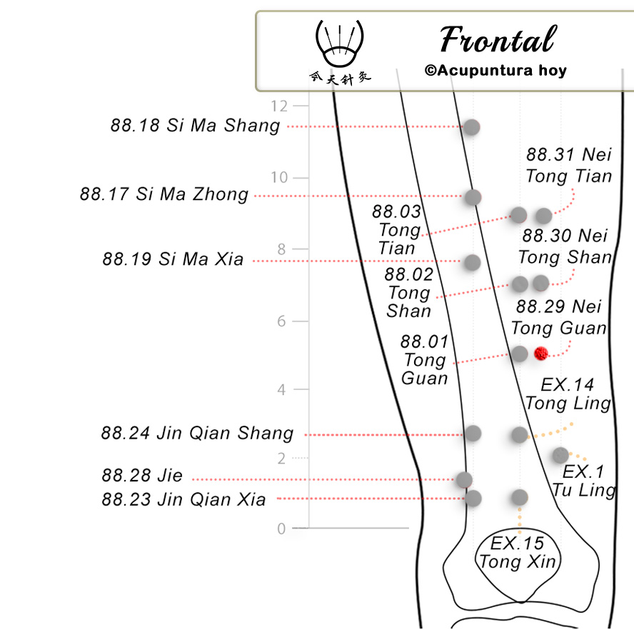88.29 Nei Tong Guan 内通闗穴