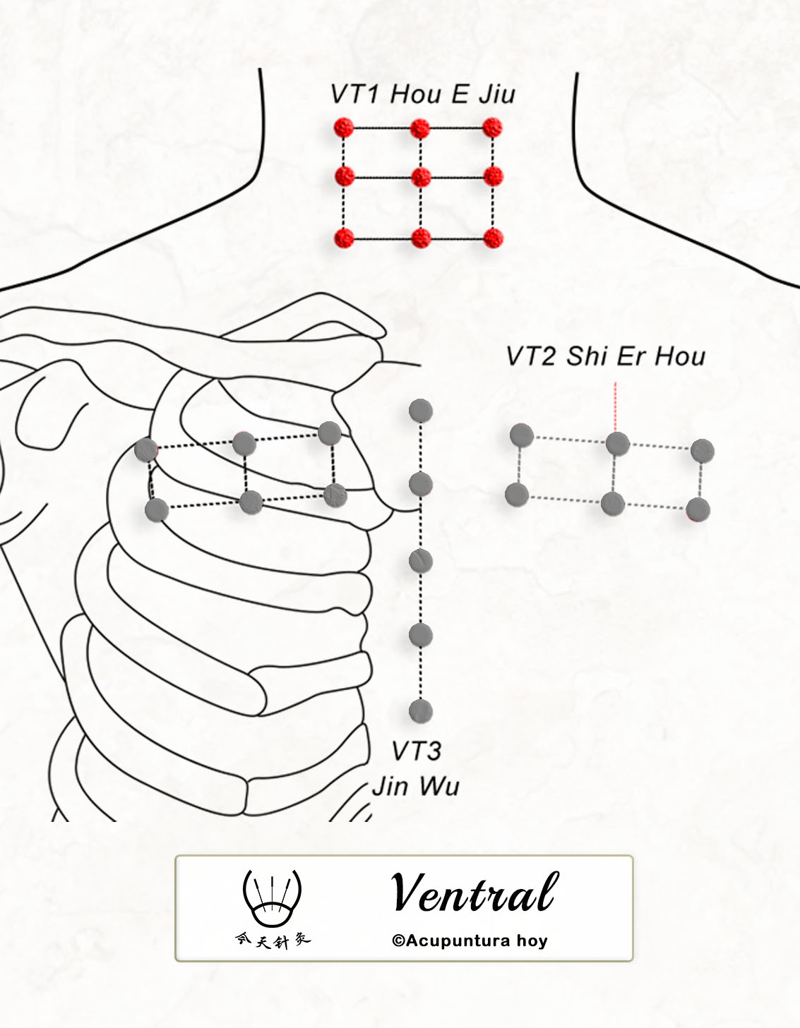 VT.01 Hou E Jiu 沖霄九穴